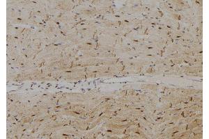 ABIN6278780 at 1/100 staining Rat heart tissue by IHC-P. (SPZ1 antibody  (Internal Region))