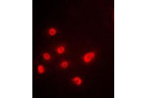 Immunofluorescent analysis of p63 staining in A549 cells.