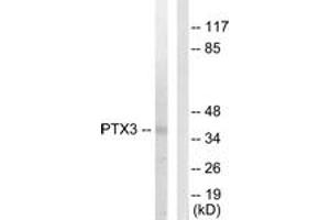 Western blot analysis of extracts from 293 cells, using PTX3 Antibody.