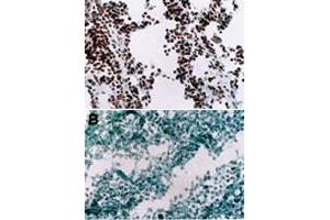 Immunohistochemistry (Frozen sections) using Myod1 monoclonal antibody, clone 5. (MYOD1 antibody  (AA 180-189))