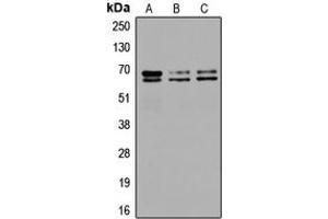 Western blot analysis of GAD1/2 expression in SKNSH (A), SP2/0 (B), PC12 (C) whole cell lysates. (GAD65+GAD67 (C-Term) antibody)