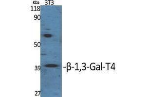 Western Blotting (WB) image for anti-UDP-Gal:betaGlcNAc beta 1,3-Galactosyltransferase, Polypeptide 4 (B3GALT4) (Internal Region) antibody (ABIN6281420)