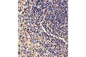 Immunohistochemistry (Paraffin-embedded Sections) (IHC (p)) image for anti-Major Histocompatibility Complex, Class I, B (HLA-B) (AA 75-107), (N-Term) antibody (ABIN1944779)