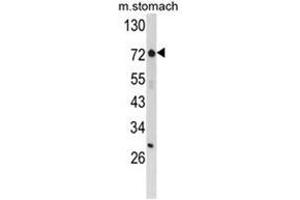 Western blot analysis of ZFP36 Antibody (ZNF823 antibody  (Middle Region))