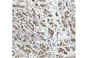 IHC analysis of PDK2 using anti-PDK2 antibody (ABIN5693279). (PDK2 antibody  (AA 81-177))