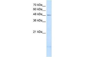 PSD3 antibody used at 2. (PSD3 antibody  (Middle Region))