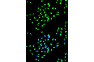 Immunofluorescence analysis of MCF-7 cells using GOLM1 antibody. (GOLM1 antibody)