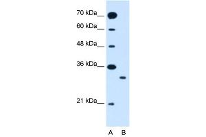 WB Suggested Anti-SLC25A22  Antibody Titration: 1.