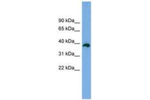 Image no. 1 for anti-Death Effector Domain Containing 2 (DEDD2) (AA 179-228) antibody (ABIN6744979) (DEDD2 antibody  (AA 179-228))