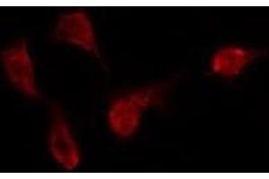 ABIN6275417 staining Hela by IF/ICC. (DYRK3 antibody)