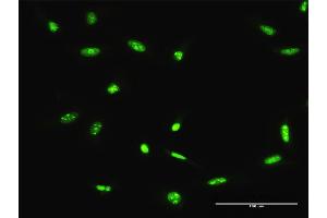 Immunofluorescence of purified MaxPab antibody to ADAR on HeLa cell. (ADAR antibody  (AA 1-1226))