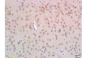 Formalin-fixed and paraffin embedded rat brain labeled with Anti-NPD014 Polyclonal Antibody, Unconjugated (ABIN1386775) at 1:200 followed by conjugation to the secondary antibody and DAB staining. (C1orf63 antibody  (AA 4-100))