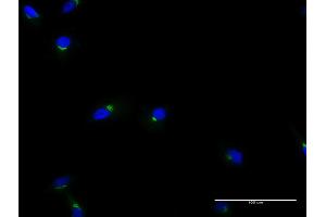 Immunofluorescence of monoclonal antibody to ACBD3 on HeLa cell.