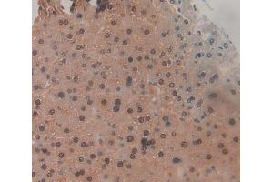 IHC-P analysis of liver tissue, with DAB staining. (TNP1 antibody  (AA 3-53))