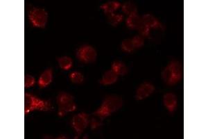 ABIN6276861 staining LOVO by IF/ICC. (Cadherin 13 antibody  (Internal Region))