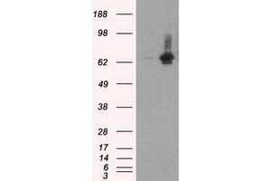 Western Blotting (WB) image for anti-RalA Binding Protein 1 (RALBP1) antibody (ABIN1500587)