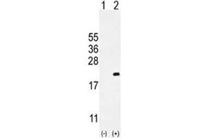 Western blot analysis of CDKN2C antibody and 293 cell lysate either nontransfected (Lane 1) or transiently transfected (2) with the CDKN2C gene.