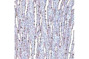 IHC analysis of SUCLG1 using anti-SUCLG1 antibody (ABIN7600906).