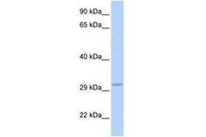 FBXO27 antibody  (C-Term)