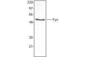 Western Blotting (WB) image for anti-FYN Oncogene Related To SRC, FGR, YES (FYN) antibody (ABIN2666047)