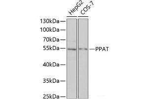 Western blot analysis of extracts of various cell lines using PPAT Polyclonal Antibody at dilution of 1:1000. (PPAT antibody)