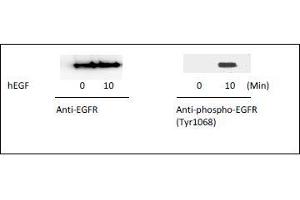 EGFR ELISA Kit