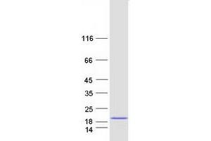 Validation with Western Blot (C1ORF21 Protein (Myc-DYKDDDDK Tag))