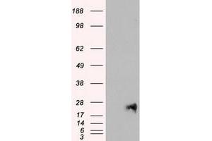 Image no. 1 for anti-Neurogenin 1 (NEUROG1) antibody (ABIN1499699) (Neurogenin 1 antibody)
