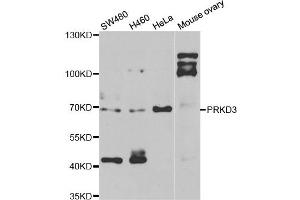 Western blot analysis of extracts of various cell lines, using PRKD3 antibody. (PRKD3 antibody)