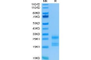 SDS-PAGE (SDS) image for Interleukin 17A (IL17A) (AA 24-155) protein (His tag) (ABIN7274991)