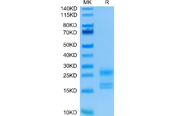 Interleukin 17a Protein (AA 24-155) (His tag)