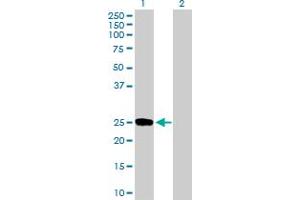 Western Blot analysis of DUSP19 expression in transfected 293T cell line by DUSP19 MaxPab polyclonal antibody. (DUSP19 antibody  (AA 1-217))