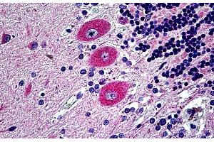 Immunohistochemistry (IHC) image for anti-EPH Receptor B6 (EPHB6) (Internal Region) antibody (ABIN7013872)