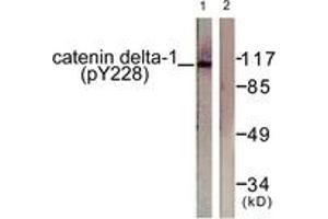 Western blot analysis of extracts from HuvEc cells, using Catenin-delta1 (Phospho-Tyr228) Antibody. (CTNND1 antibody  (pTyr228))