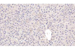 Detection of CRP in Rat Liver Tissue using Monoclonal Antibody to C Reactive Protein (CRP) (CRP antibody  (AA 20-230))