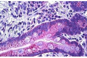 Human Intestine, Epithelium: Formalin-Fixed, Paraffin-Embedded (FFPE) (IRS1 antibody  (AA 289-338))