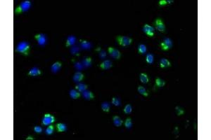 Immunofluorescence staining of Hela cells with ABIN7170052 at 1:160, counter-stained with DAPI. (ATP1B3 antibody  (AA 57-279))