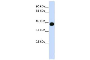 Western Blotting (WB) image for anti-Sphingolipid Delta(4)-Desaturase DES1 (DEGS1) antibody (ABIN2458939) (DEGS1 antibody)