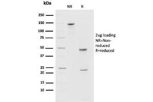 SDS-PAGE Analysis of Purified PD1 (CD279) Mouse Monoclonal Antibody (PDCD1/2720). (PD-1 antibody)