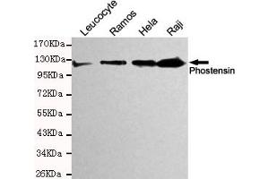 Western blot detection of Phostensin in Hela,Raji,Ramos and Leucocyte cell lysates and using Phostensin mouse mAb (1:200 diluted). (KIAA1949 antibody)
