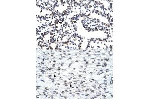 Immunohistochemical staining (Formalin-fixed paraffin-embedded sections) of (A) human lung and (B) human heart tissues with LHX3 polyclonal antibody .