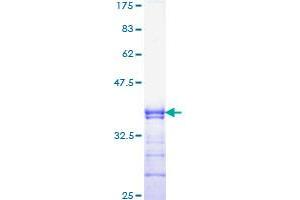 Image no. 1 for Runt-Related Transcription Factor 2 (RUNX2) (AA 251-350) protein (GST tag) (ABIN1318998) (RUNX2 Protein (AA 251-350) (GST tag))