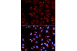 Immunofluorescence analysis of U2OS cell using MAOB antibody. (Monoamine Oxidase B antibody  (AA 1-260))