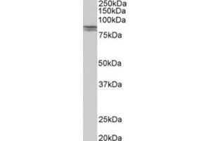 AP31777PU-N CDH1 antibody staining of Human kidney lysate at 0. (E-cadherin antibody  (Internal Region))