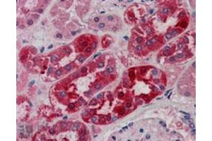 Image no. 1 for anti-Midline 2 (MID2) (C-Term) antibody (ABIN374299) (Midline 2 antibody  (C-Term))