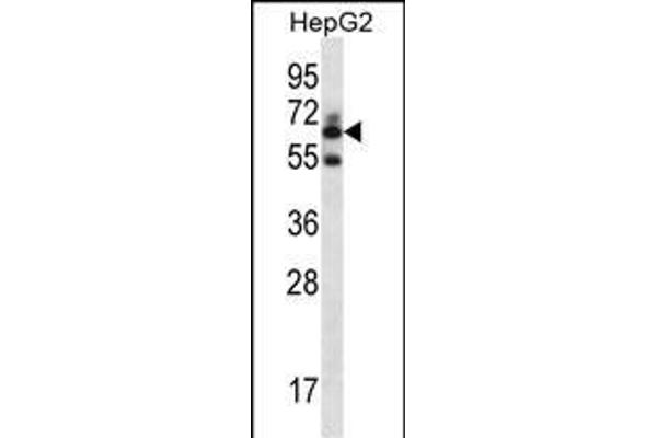 gGT2 antibody  (N-Term)