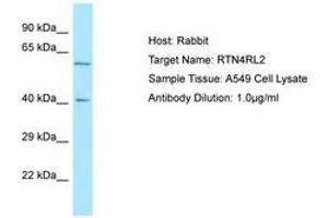 Image no. 1 for anti-Reticulon 4 Receptor-Like 2 (RTN4RL2) (C-Term) antibody (ABIN6750022) (RTN4RL2 antibody  (C-Term))