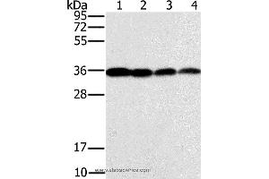Western blot analysis of Raji, Jurkat, 293T and hela cell, using CENPV Polyclonal Antibody at dilution of 1:200 (CENPV antibody)