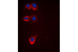 Immunofluorescent analysis of BCL2 staining in HeLa cells. (Bcl-2 antibody  (Center))