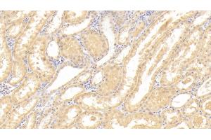 Detection of CASP3 in Human Kidney Tissue using Polyclonal Antibody to Caspase 3 (CASP3) (Caspase 3 antibody  (AA 183-277))